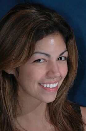 Invisalign: Isabel - After