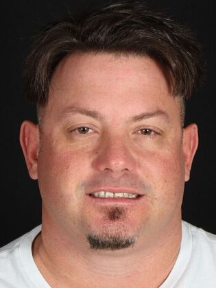 Porcelain Veneers: Mike - Before