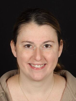 Dental Implants Lauren - Before