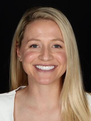 Porcelain Veneers: Jamie - After