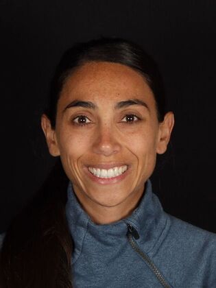 Full Mouth Rehabilitation Noor - Before