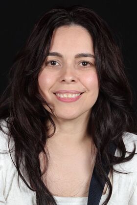 Full Mouth Rehabilitation Jessica - Before