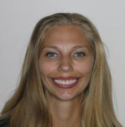 Porcelain Crowns Case 1 - After