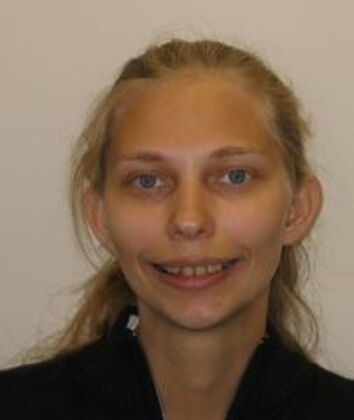 Porcelain Crowns Case 1 - Before