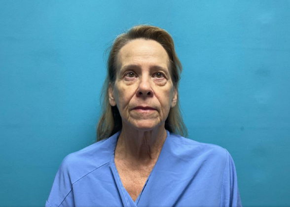 Facelift Case 7 - Before