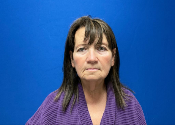 Facelift Case 4 - Before