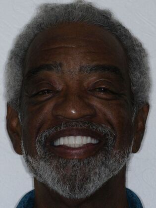 Dental Implants Ken - After