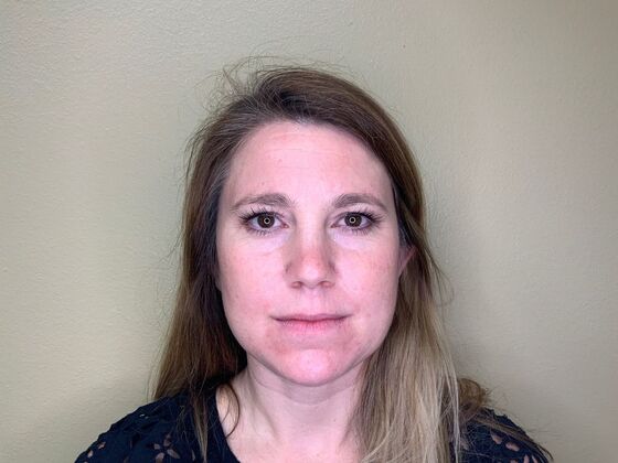 Botox® Cosmetic: Case 3 - Before