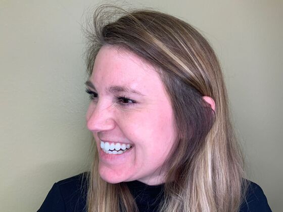 Botox® Cosmetic: Case 3 - After