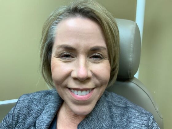 Botox® Cosmetic: Case 4 - Before