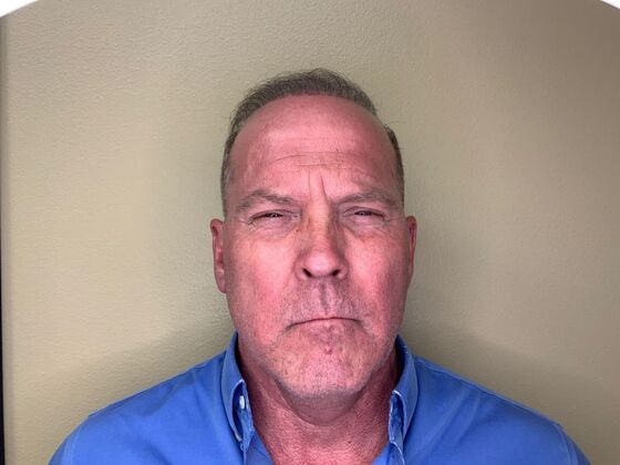 Botox® Cosmetic: Case 5 - Before