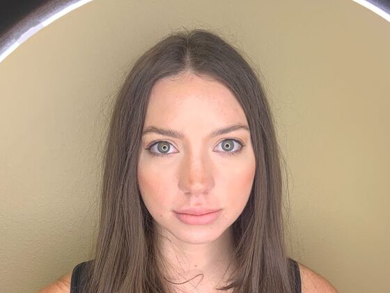 Filler Case 3 - After