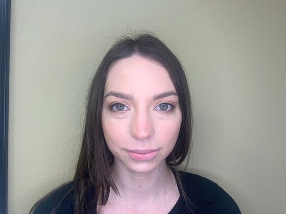 Filler Case 3 - Before