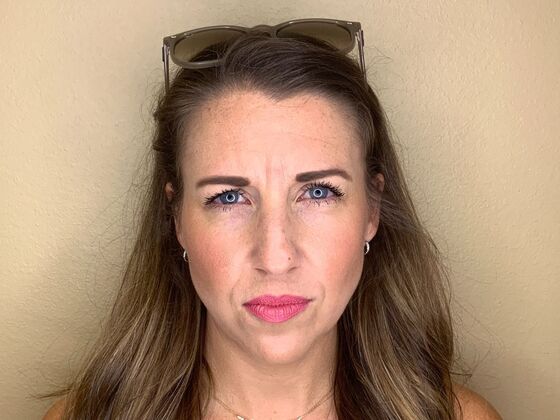 Botox® Cosmetic: Case 8 - Before