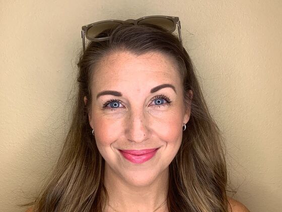 Botox® Cosmetic Case 8 - Before