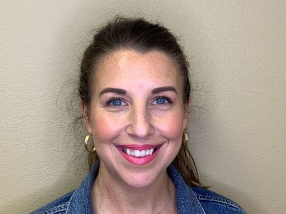 Botox® Cosmetic Case 8 - After