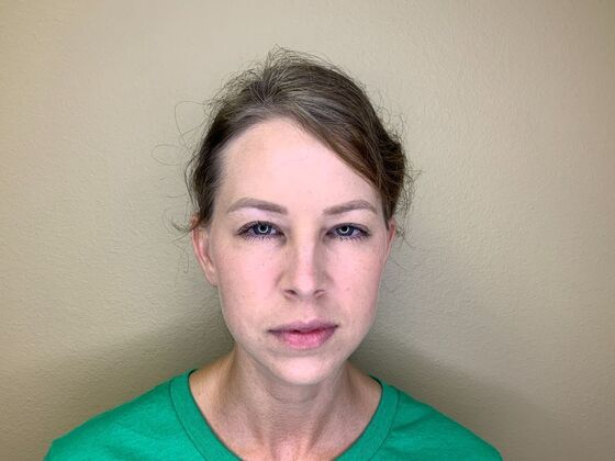 Botox® Cosmetic: Case 9 - After