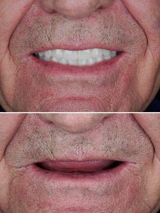 Before and After Case 2