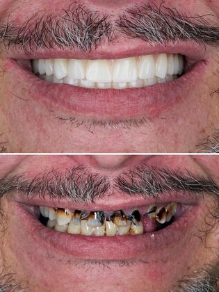 Before and After Case 3