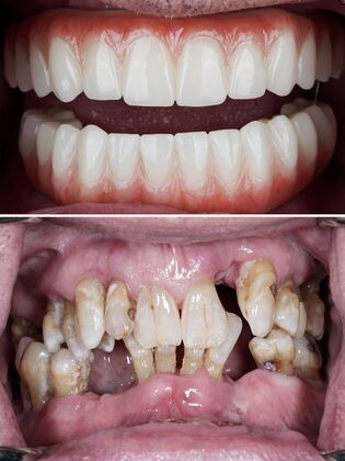 Before and After Case 6
