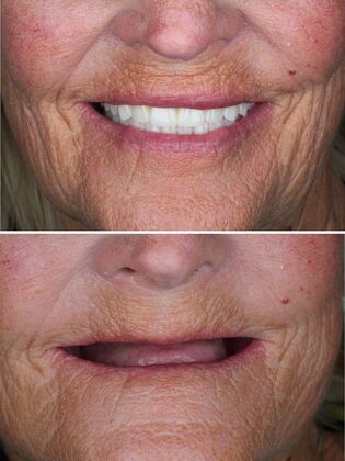 Before and After Case 7