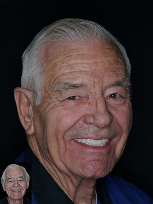 Before and After Case 8