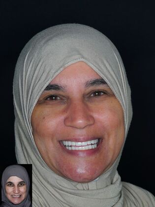 Before and After Case 9