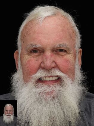 Before and After Case 10