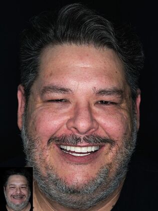 Before and After Case 11