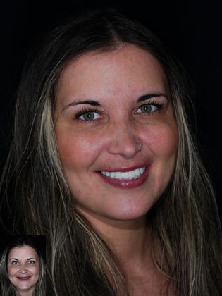 Before and After Case 12