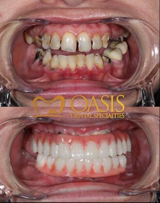 Smile Transformations Case 2