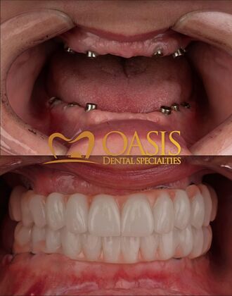Smile Transformations Case 3