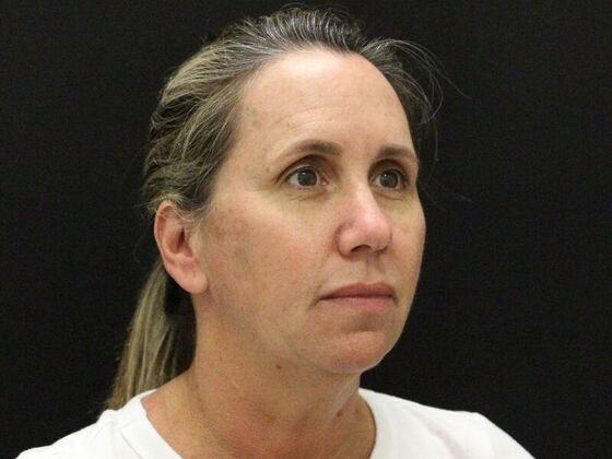 Face & Neck Lifts: Case 56 - Before