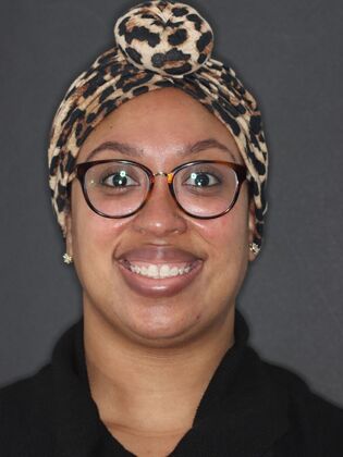 Smile Makeover Antionette - Before