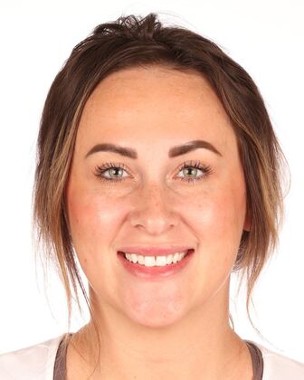 Smile Makeover Brooke - Before