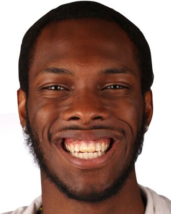 Smile Makeover Bryce - Before