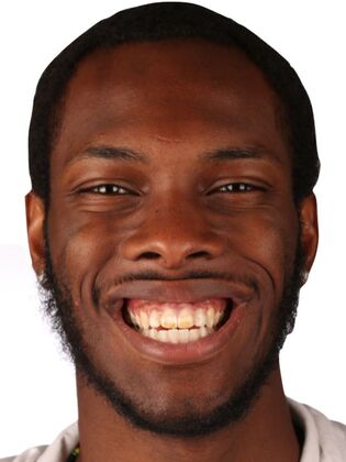 Smile Makeover Bryce - Before