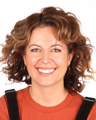 Smile Makeover Caroline - After