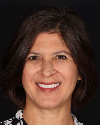 Smile Makeover Desiree - After