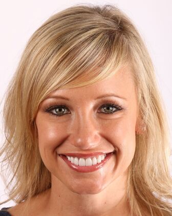 Smile Makeover Erin - After