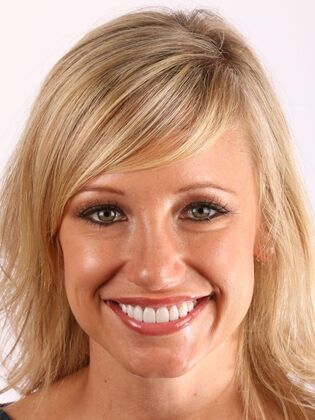 Smile Makeover Erin - After