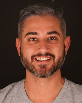 Smile Makeover Hassan - Before