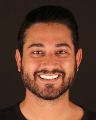 Smile Makeover Hassan - After