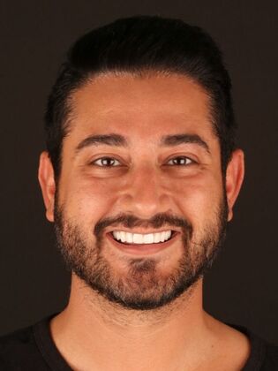 Smile Makeover Hassan - After