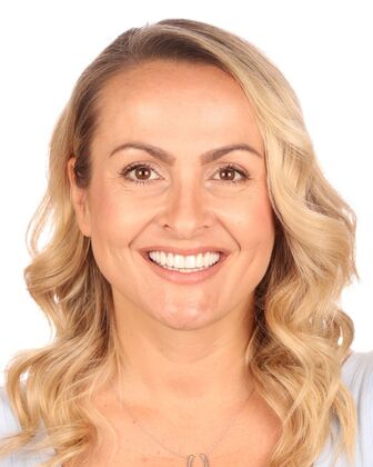 Smile Makeover Jasmina - After