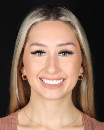 Smile Makeover Jess - After