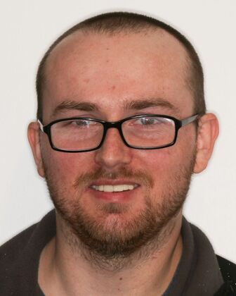 Smile Makeover Joe - Before