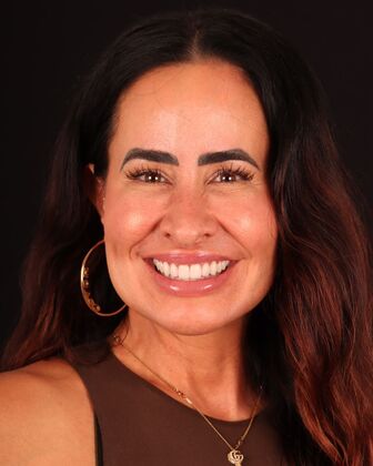 Smile Makeover Katie - After