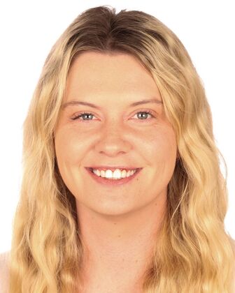 Smile Makeover Lavonne - Before