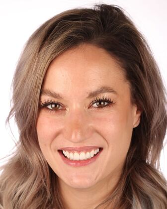 Smile Makeover Lucy - After